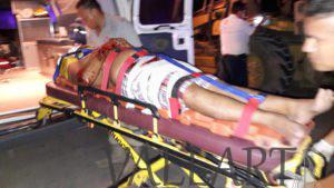 Prensado y fracturado tras chocar contra una máquina sin luces