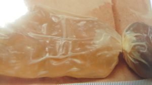 Traía desde Perú cocaína líquida en su cuerpo, ahora está tras las rejas