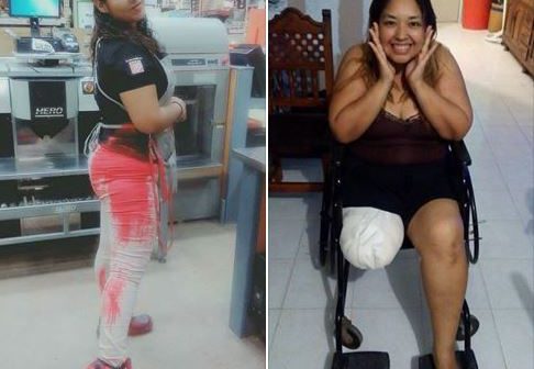 IRIS TORRES NO SE DESALIENTA TRAS TERRIBLE ACCIDENTE EN CRUCERO DE LAS JUNTAS.