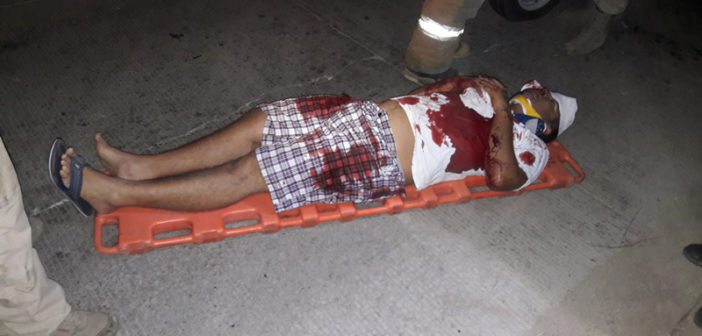 Prensado y fracturado tras chocar contra una máquina sin luces