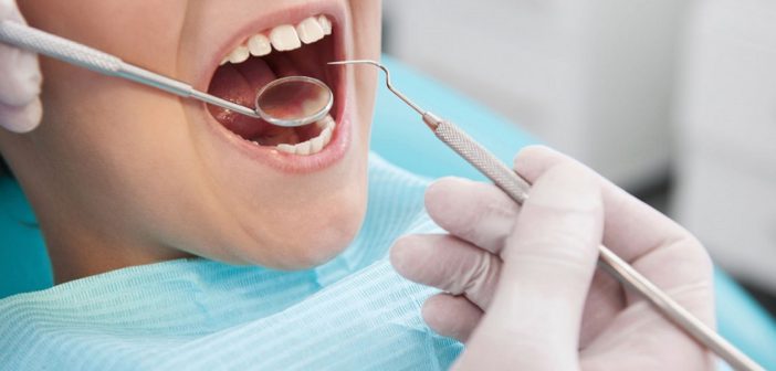 Caries, un mal generalizado entre mexicanos