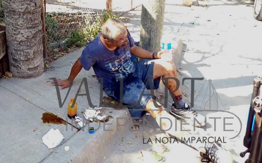 Lo atrapan, amarran, golpean, pero logra escapar