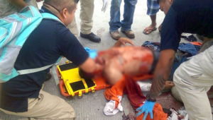 Atropellan dos veces a un motociclista; está malherido