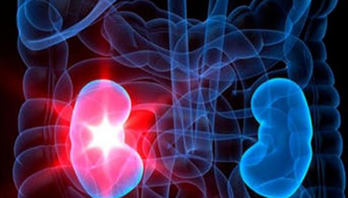 Van en aumento pacientes con insuficiencia renal en el país