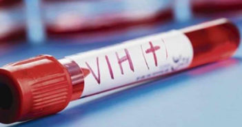 Existen en Puerto Vallarta alrededor de 2500 casos de VIH