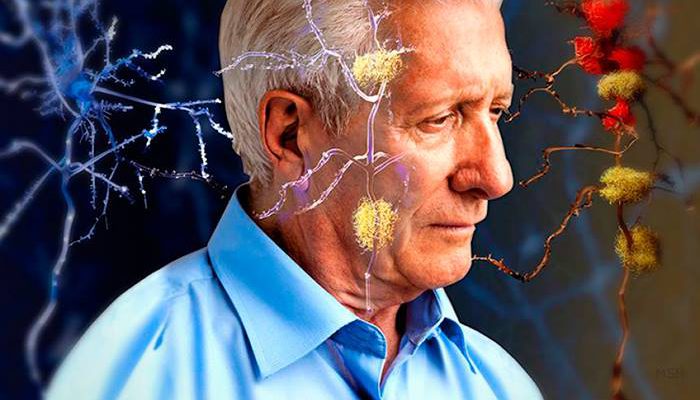 Descubren forma de detener el avance de Alzheimer