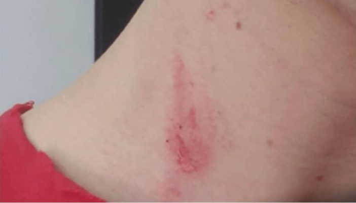 ¿Chupetón o cortada? Pidió una opinión y... "Amigo, date cuenta"