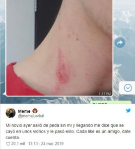 ¿Chupetón o cortada? Pidió una opinión y... "Amigo, date cuenta" 1 ¿Chupetón o cortada? Pidió una opinión y... "Amigo, date cuenta"