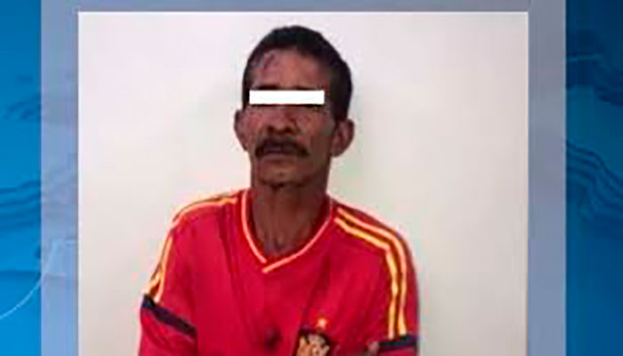 Hombre quema con ácido a su bebé de 3 años y a expareja