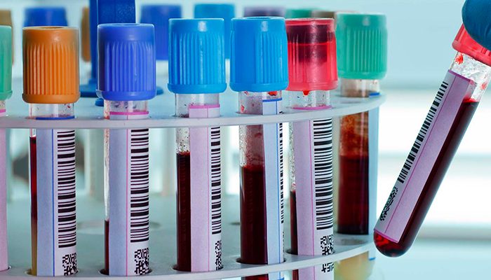Nueva prueba de sangre podría detectar hasta 7 tipos de cáncer