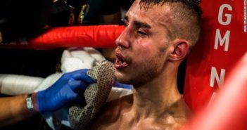 Muere boxeador ruso tras pelear el viernes pasado