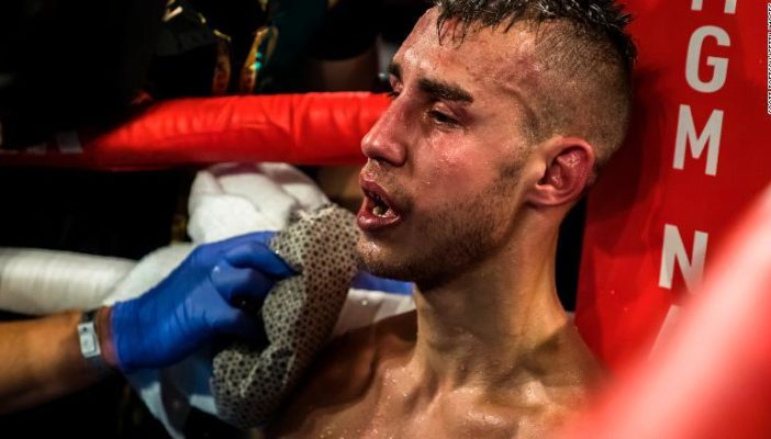 Muere boxeador ruso tras pelear el viernes pasado