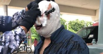 Peleaba por un lugar de estacionamiento y terminó con un cuchillo en el ojo