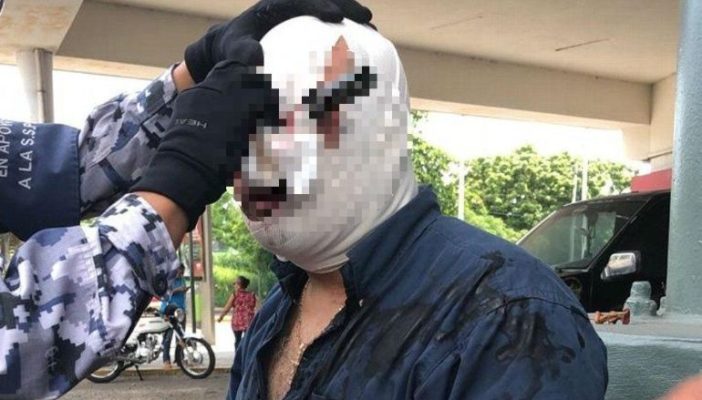 Peleaba por un lugar de estacionamiento y terminó con un cuchillo en el ojo