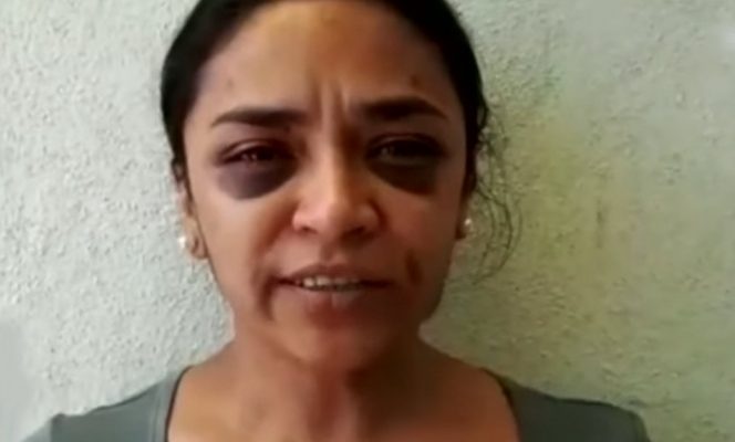 Periodista iba a ser violada, pide ayuda a policías y la golpean
