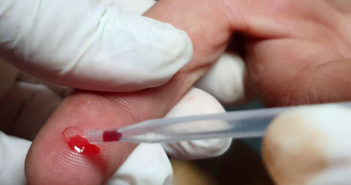 IMSS indica que hay tres mil casos de VIH al año en el país