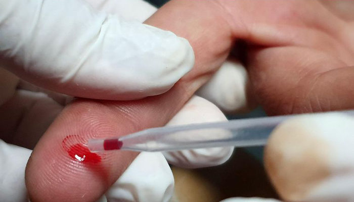 IMSS indica que hay tres mil casos de VIH al año en el país