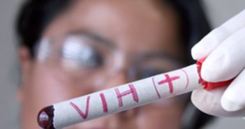 Reporta IMSS cobertura casi total en medicinas para VIH en Jalisco