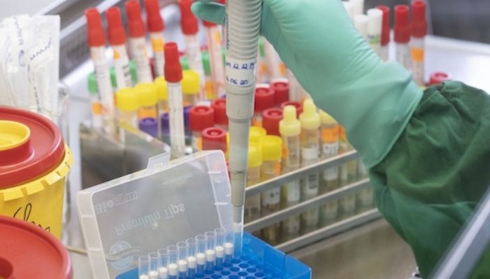 Solo se han hecho 35 pruebas de Covid19 en Jalisco