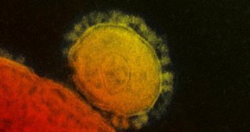 Se 'rodea' Puerto Vallarta de coronavirus