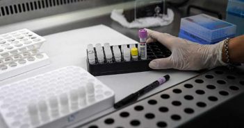 Inicia PV la 'semana clave' con 41 casos de Covid-19 y 5 defunciones