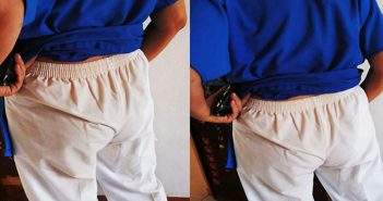 Agreden con café hirviendo a enfermera en Yucatán