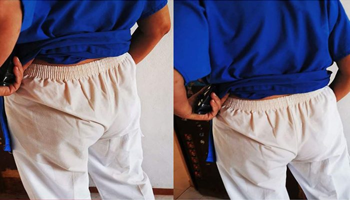 Agreden con café hirviendo a enfermera en Yucatán