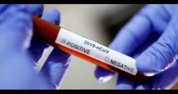 Nayarit tiene 21 casos confirmados de Covid-19