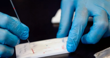 Reportan a menor de siete años con dengue y COVID-19 en BCS