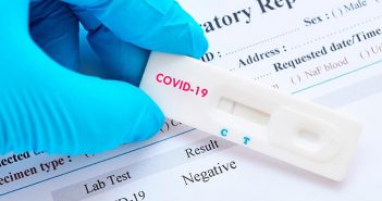 Venden pruebas 'piratas' para detectar Covid-19 en PV y Guadalajara