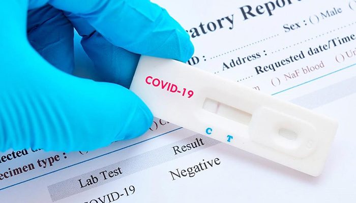 Venden pruebas 'piratas' para detectar Covid-19 en PV y Guadalajara