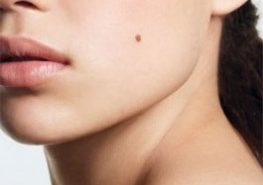 Covid-19, afecta también a otros órganos como la piel, dermatólogo UNAM