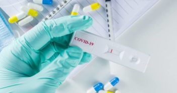 60 mil pruebas de 15 minutos fueron compradas por el gobierno de Jalisco