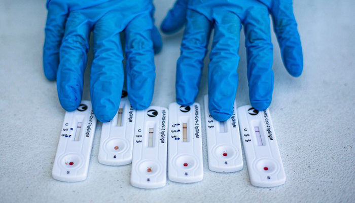 A partir del miércoles harán pruebas masivas en el sector educativo en Jalisco