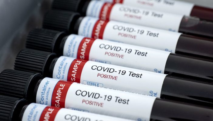 Estados Unidos pedirá prueba negativa de Covid para ingresar al país