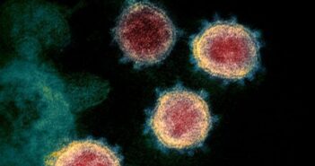 Ubican cuatro casos de la variante sudafricana del virus en Jalisco