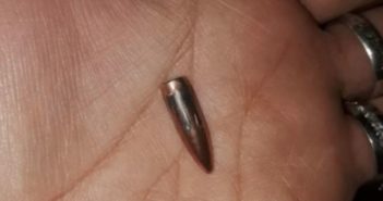 Bala perdida impacta a una joven en la cabeza en Ixtlán del Río