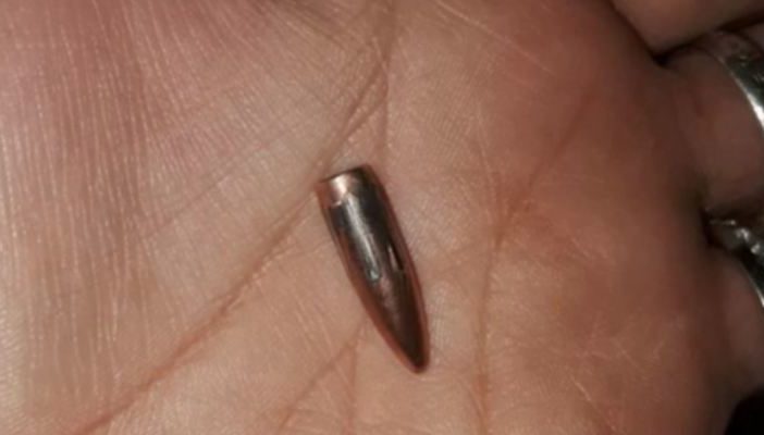 Bala perdida impacta a una joven en la cabeza en Ixtlán del Río