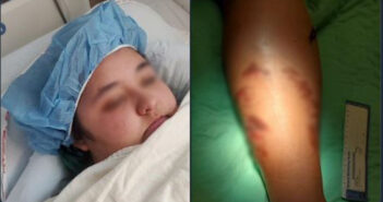 Cocodrilo ataca a turista estadounidense en Puerto Vallarta