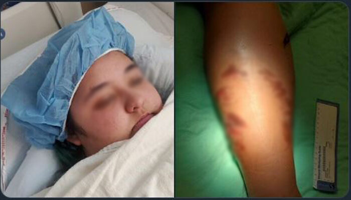 Cocodrilo ataca a turista estadounidense en Puerto Vallarta