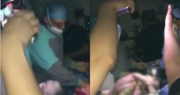 Realizan cesárea sin luz y le cortan la oreja al bebé