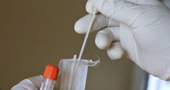 Identifica SSJ 3 casos sospechosos más de hepatitis grave