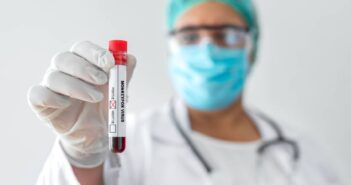 Confirman otro caso de la viruela del mono en Puerto Vallarta