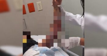 Prenden fuego a una menor en albergue de Tonalá