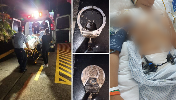 Miguel continúa grave, el niño atropellado por un RZR