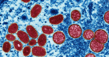 México acumula 2,468 casos de viruela del mono: SSa