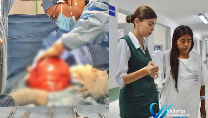 retiran tumor en Nayarit