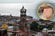 Confirman tercer caso de sarampión en Puerto Vallarta