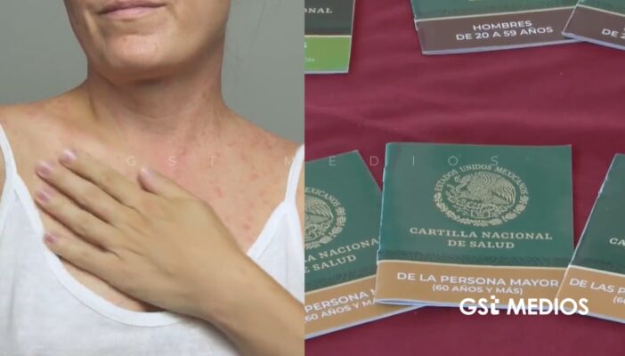 Gobierno de Nayarit refuerza medidas sanitarias ante riesgo por brotes de sarampión en Jalisco