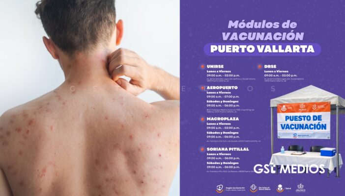 Dan a conocer módulos de vacunación contra el sarampión en Puerto Vallarta ante aumento de casos en Jalisco